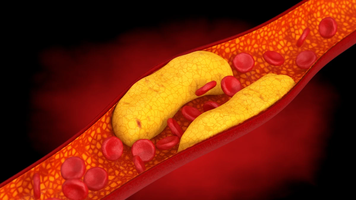 5 Surprising Foods That Lower Cholesterol Better Than Oatmeal