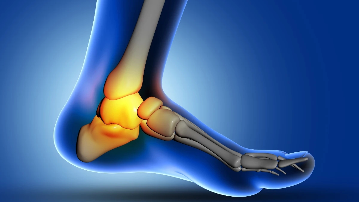 Structural Shifts: Bunions and Hammer Toes