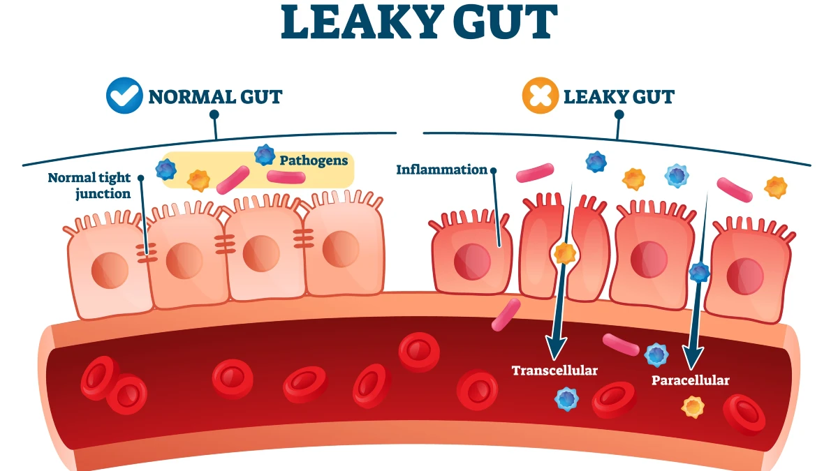 The "Leaky" Inflammatory Engine